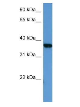 Polyclonal Rabbit anti-Human MAPKAPK2 / MAPKAP Kinase 2 Antibody (aa184-233, WB)