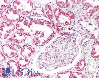 IHC-plus™ MUC20 Antibody (aa654-684)