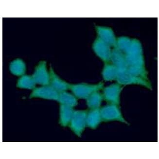 ALDH5A1 Antibody (clone AT17F5)