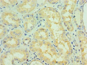 NTRK2 / TRKB Antibody (aa32-282)