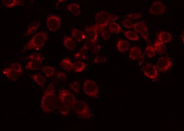 Polyclonal Rabbit anti-Human OR11L1 Antibody (IF, WB)