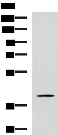 Polyclonal Rabbit anti-Human GRAB / RAB3IL1 Antibody (WB)