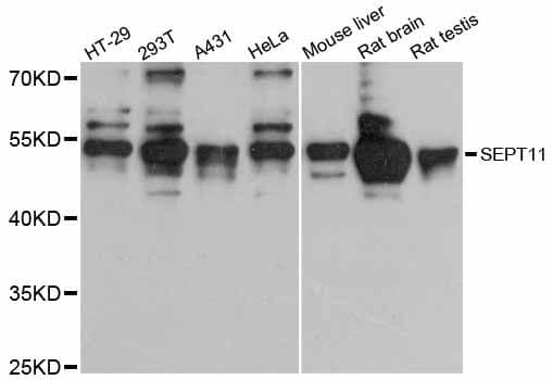 SEPT11 / Septin 11 Antibody