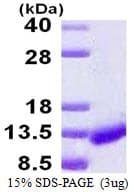 Human CARD18 / ICEBERG Protein (Recombinant His)