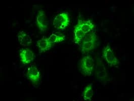 LOX / Lysyl Oxidase Antibody (clone OTI7E6)