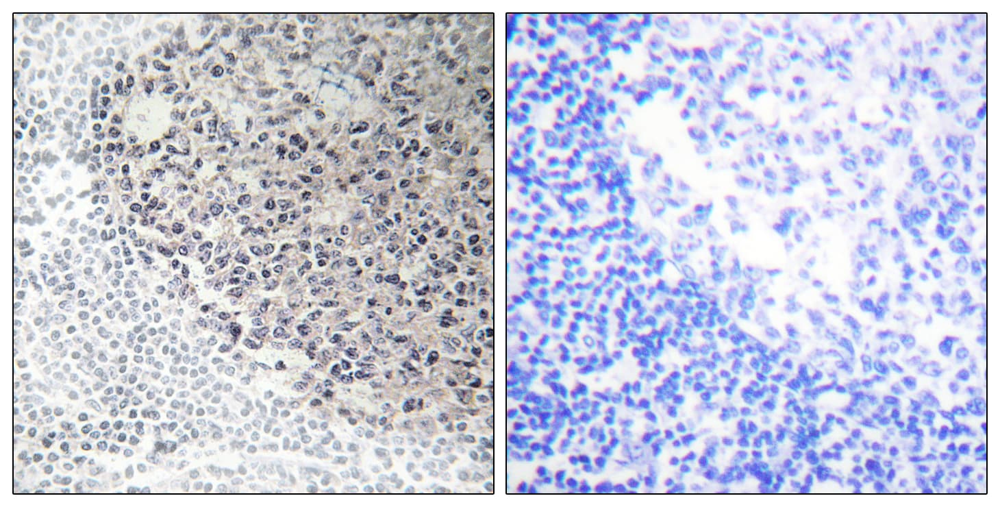 COL9A3 / Collagen IX Antibody (aa321-370)