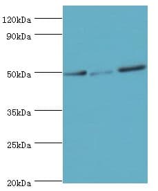 Polyclonal Rabbit anti-Human PTP1B Antibody (aa281-435, WB)