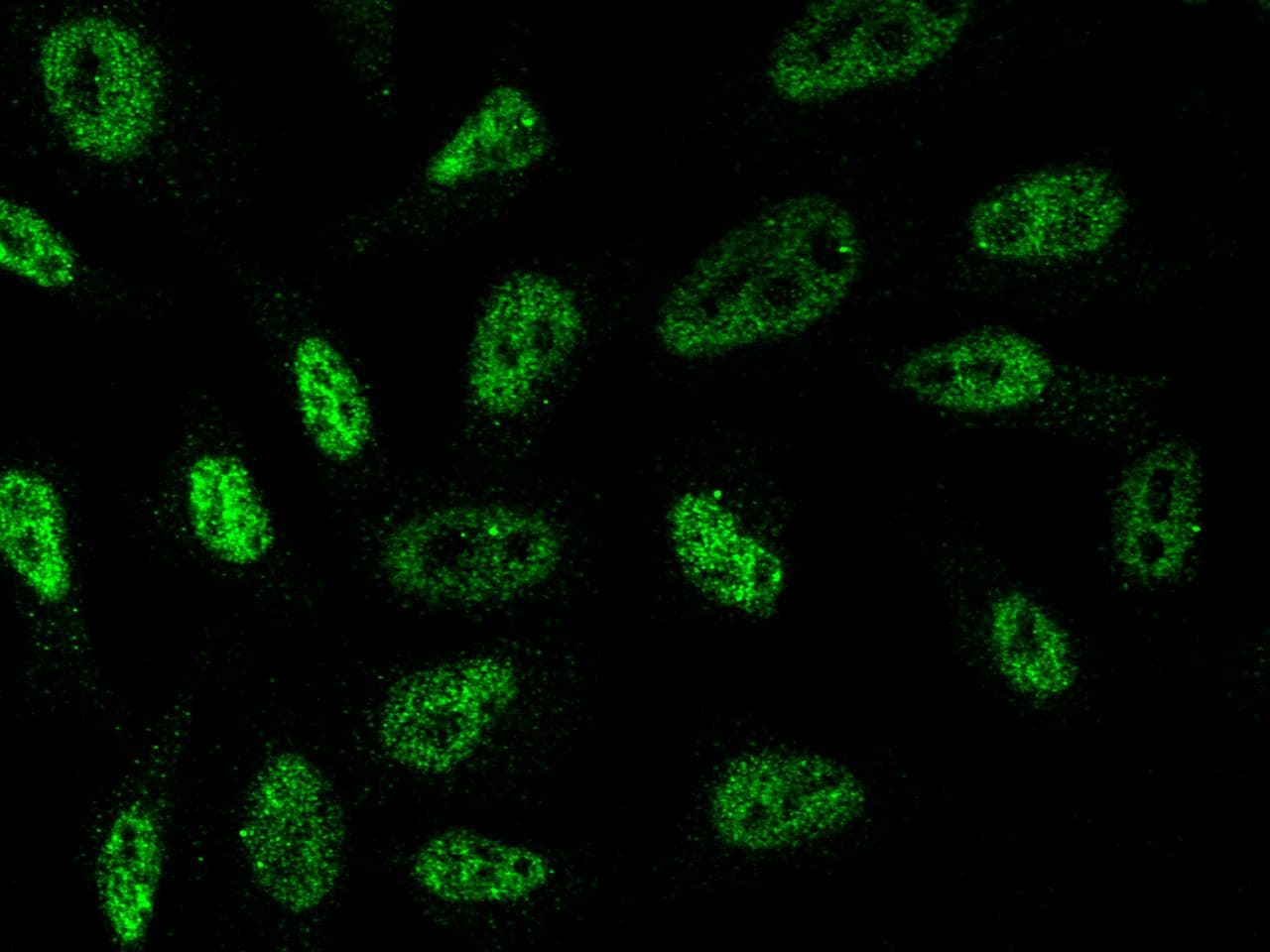 TBXT / T / Brachyury Antibody (clone 07, Preservative Free)