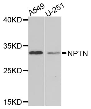 Polyclonal Rabbit anti-Human NPTN / SDR1 Antibody (WB)