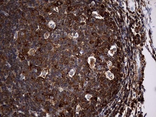 RGS10 Antibody (clone OTI1B10)