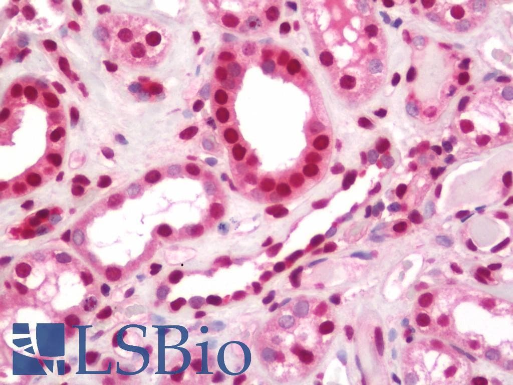 IHC-plus™ Monoclonal Mouse anti-Human NHLH1 / HEN1 Antibody (clone 4D7, IHC)