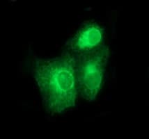 BMP1 Antibody (aa225-617, clone OTI3E9, Carrier-free)