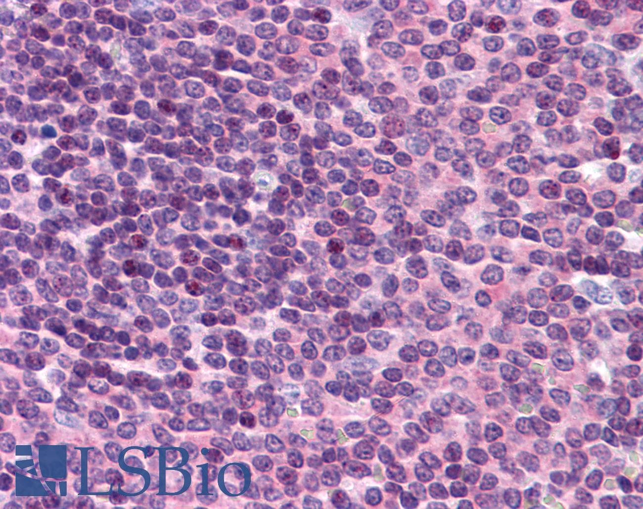 IHC-plus™ GNPDA2 Antibody