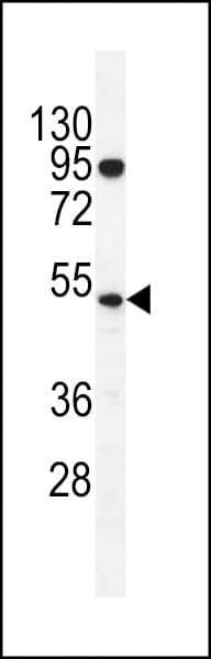 DNTT / TdT Antibody (aa438-467)