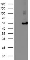 HARS2 Antibody (clone OTI5H2)