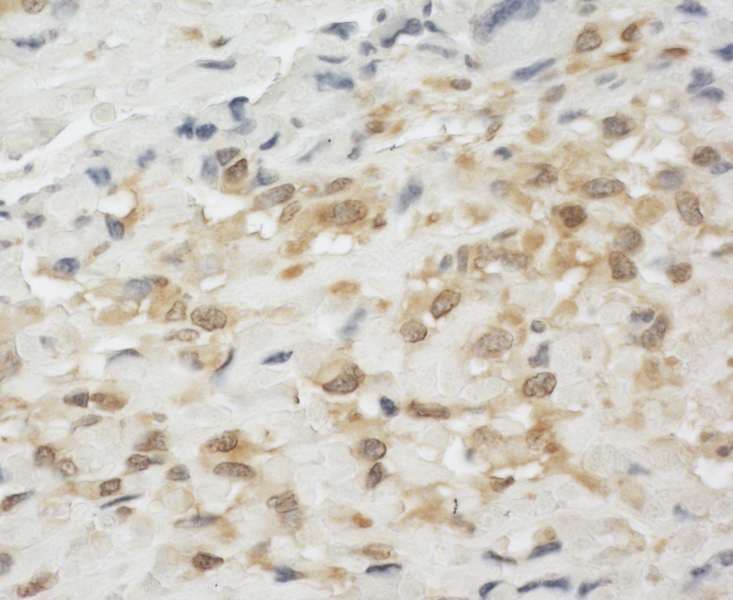 LIM Protein / LPP Antibody (aa75-125)