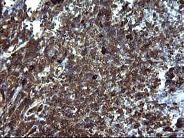 SERPINB3 Antibody (clone OTI1G9)