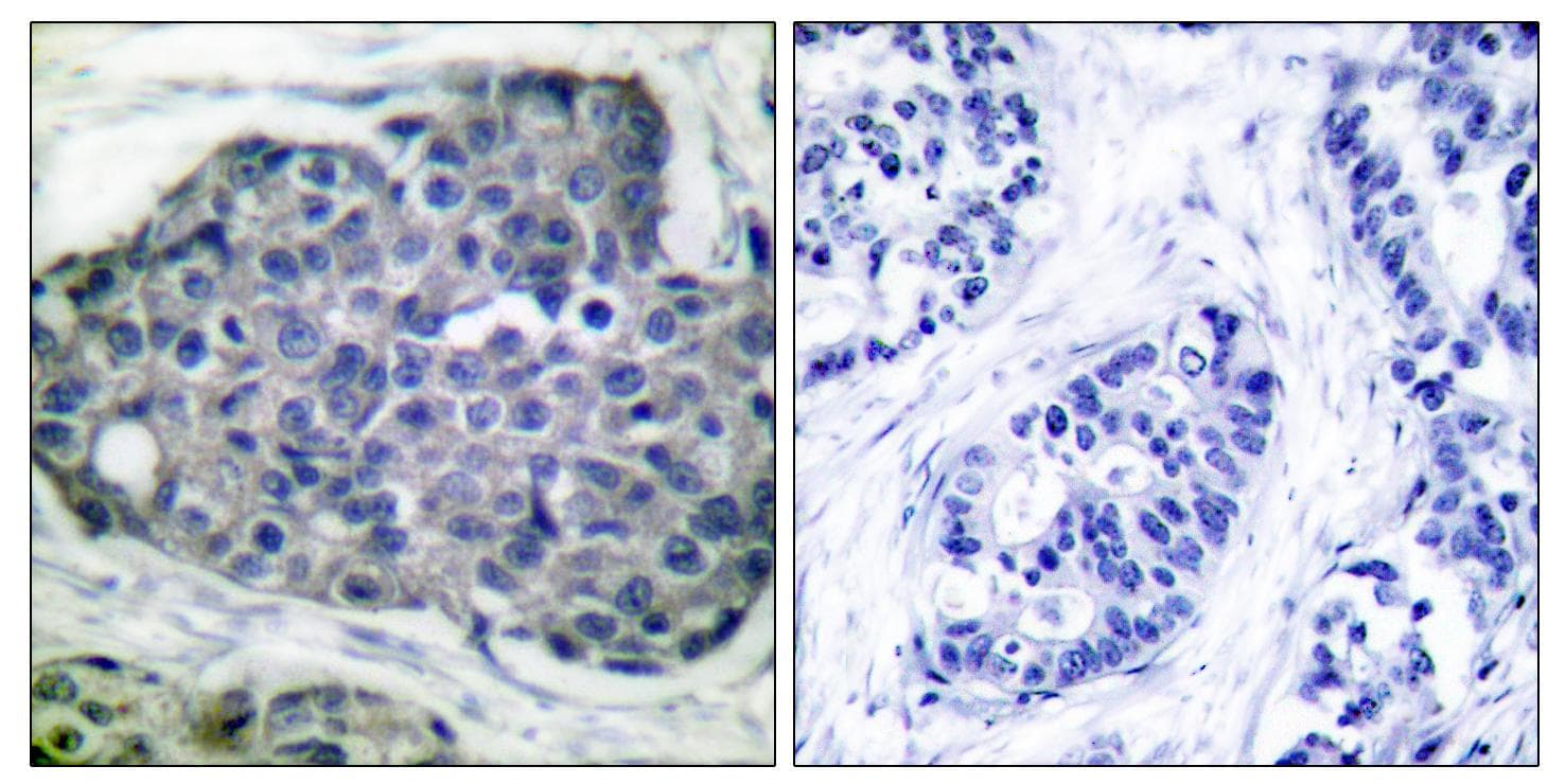 Polyclonal Rabbit anti-Human Acetyl-CoA Carboxylase / ACC Antibody (phospho-Ser80, IHC, WB)