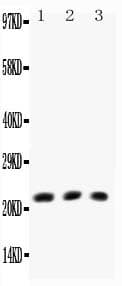 LTA / TNF Beta Antibody (aa45-59)
