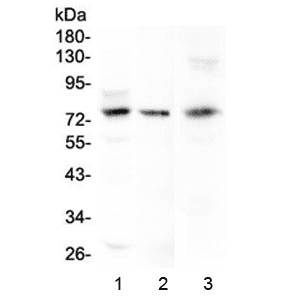 Polyclonal Rabbit anti-Human MAC-2-BP / LGALS3BP Antibody (IHC, WB)