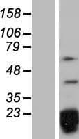 SNRPD2 Protein (Over-Expression Lysate Myc-DDK (Flag))