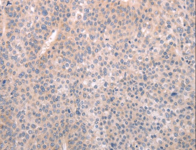 ABCF1 Antibody