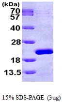 Human EIF1AX Protein (Recombinant His)