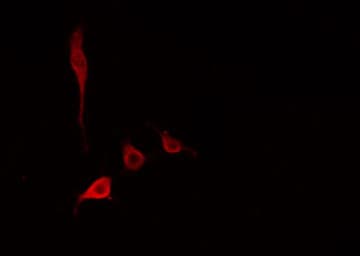 RPL34 / Ribosomal Protein L34 Antibody