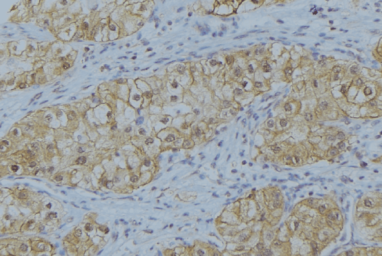 COL5A1 / Collagen V Alpha 1 Antibody