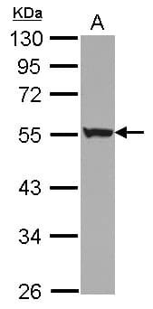 KRT72 / Keratin 72 / K6irs Antibody