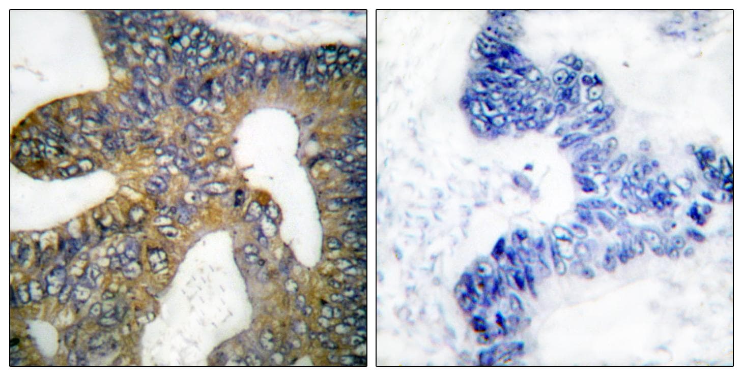 Polyclonal Rabbit anti-Human HSPH1 / HSP105 Antibody (IHC, IF, WB)