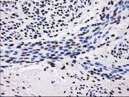 Monoclonal Mouse anti-Human SORD / Sorbitol Dehydrogenase Antibody (clone OTI13G5, IHC, WB)