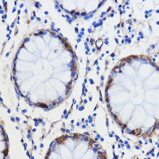 Polyclonal Rabbit anti-Human GCAT Antibody (IHC, IF, WB)