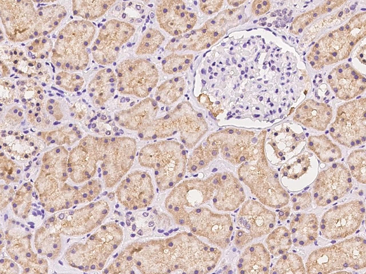 KLHL25 Antibody