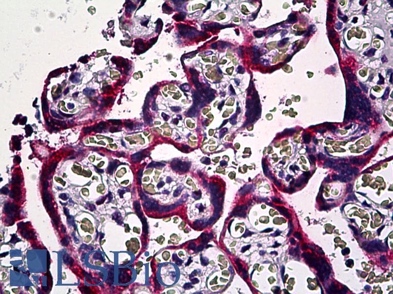 IHC-plus™ Monoclonal Mouse anti-Human SMAD3 Antibody (clone 2C12, IHC, WB)