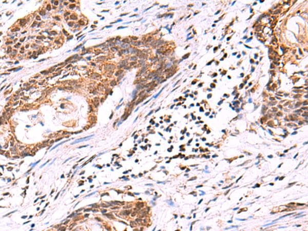 Polyclonal Rabbit anti-Human KATNAL1 Antibody (IHC)