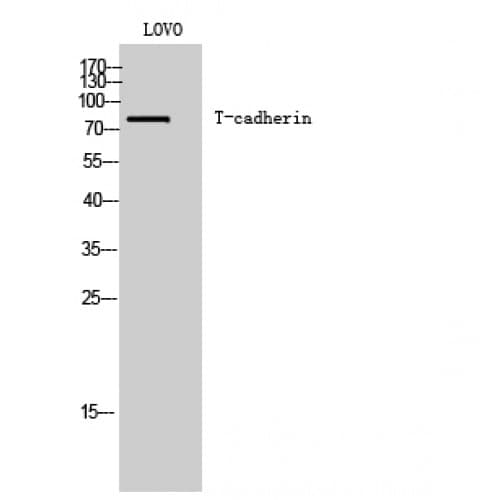 CDH13 / Cadherin 13 Antibody (300-380 aa, Internal)