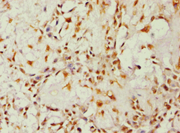 IHC-plus™ ALDH1B1 Antibody (aa278-517)