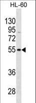 Polyclonal Rabbit anti-Human VIPR1 Antibody (aa305-334, WB)