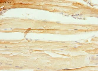 Polyclonal Rabbit anti-Human CXXC4 Antibody (IHC, WB)