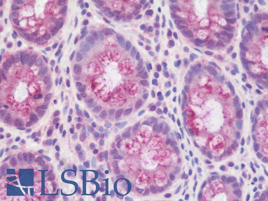 PathPlus™ Polyclonal Rabbit anti-Human EFNB2 / Ephrin B2 Antibody (aa157-186, IHC, IF, WB)