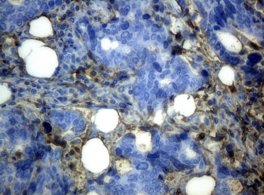 HP / Haptoglobin Antibody (clone UMAB10, Carrier-free)