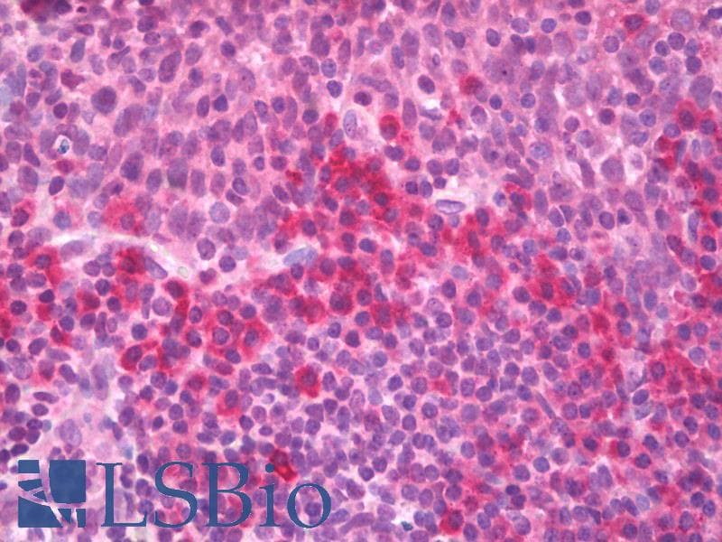 IHC-plus™ TNF Alpha Antibody