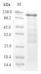 Mouse CBS Protein (Recombinant 6His-SUMO, N-terminus)