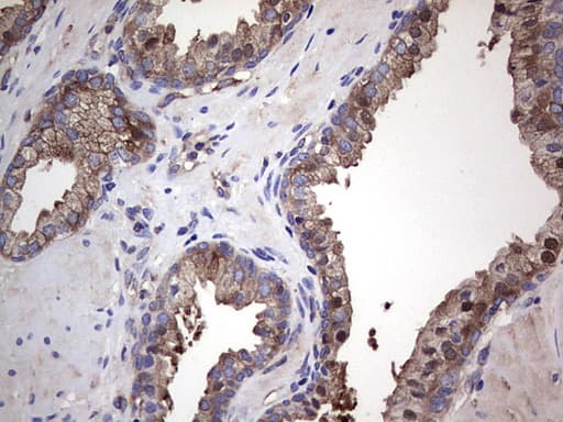 GARS / Glycyl tRNA Synthetase Antibody (clone OTI4G4)