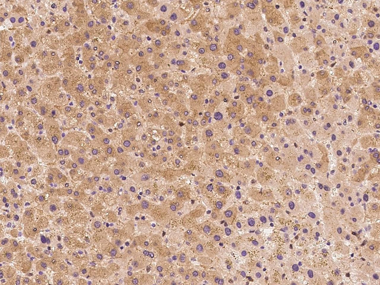 NMT2 Antibody