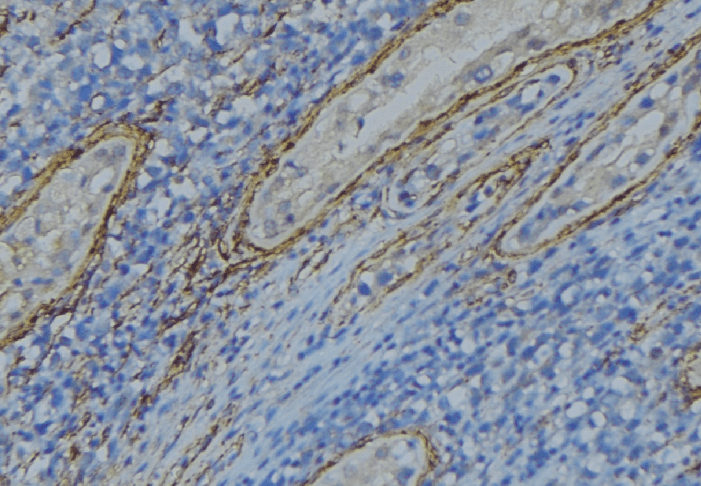 Polyclonal Rabbit anti-Human CBLN4 / Cerebellin 4 Antibody (IHC, IF, WB)