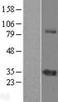ZNF691 Protein (Over-Expression Lysate Myc-DDK (Flag))