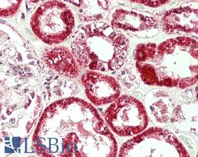 IHC-plus™ FH / Fumarase / MCL Antibody (clone 3E7)