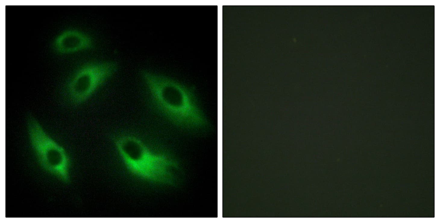 IHC-plus™ EPHB6 / EPH Receptor B6 Antibody (aa861-910)